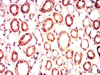 HMGCR Antibody