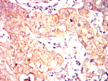 HMGCR Antibody