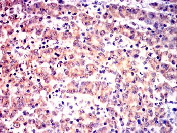 PYCARD Antibody