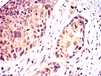 PYCARD Antibody