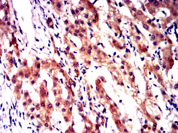 PYCARD Antibody