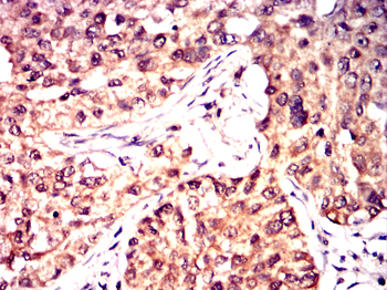 PYCARD Antibody