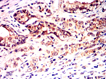 PYCARD Antibody