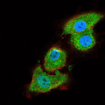 AURKB Antibody
