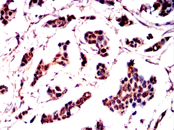 AURKB Antibody