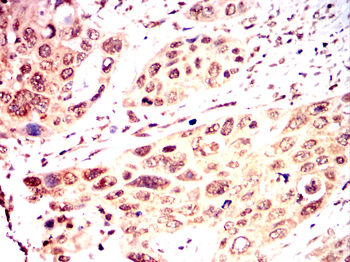 AURKB Antibody