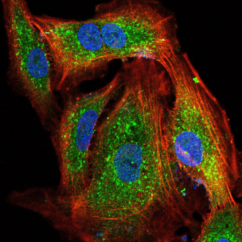 CPT2 Antibody