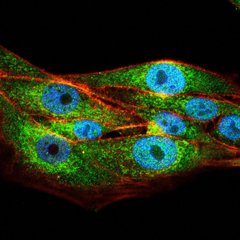 SGK1 Antibody