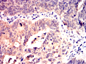 SGK1 Antibody
