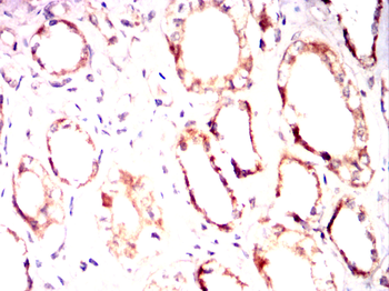 SGK1 Antibody