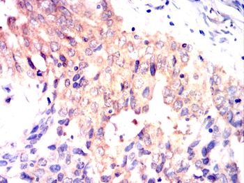 SGK1 Antibody