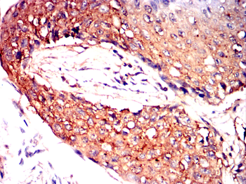 IGF2R Antibody