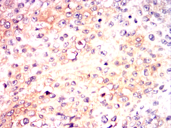 IGF2R Antibody