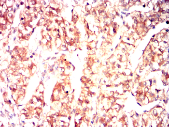 IGF2R Antibody