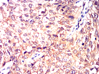 GHR Antibody