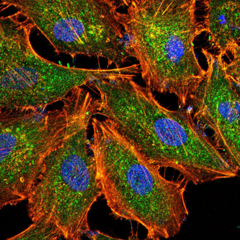 CHEK1 Antibody