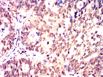 CHEK1 Antibody