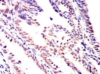CHEK1 Antibody