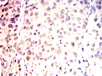 CHEK1 Antibody