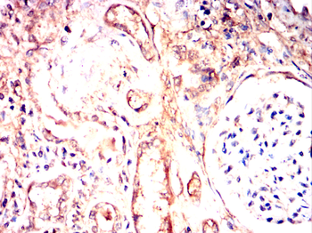 CCL3 Antibody
