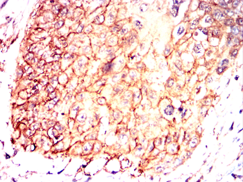 CCL3 Antibody