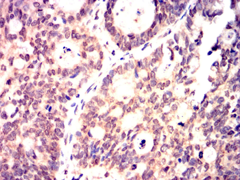 EEF2 Antibody