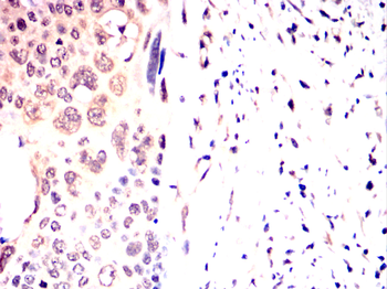 EEF2 Antibody