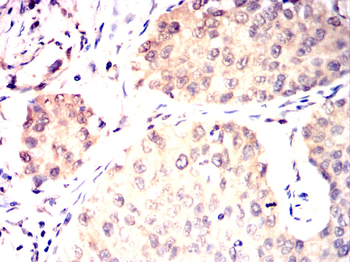 EEF2 Antibody