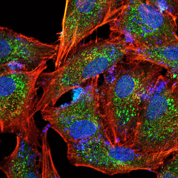 PDGFRA Antibody