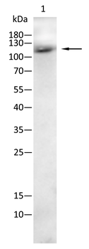 PDGFRA Antibody