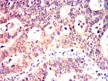 HDAC2 Antibody