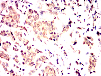 HDAC2 Antibody