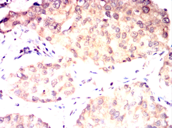 HDAC2 Antibody