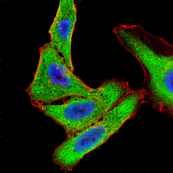 NGFR Antibody