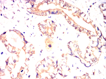 NGFR Antibody