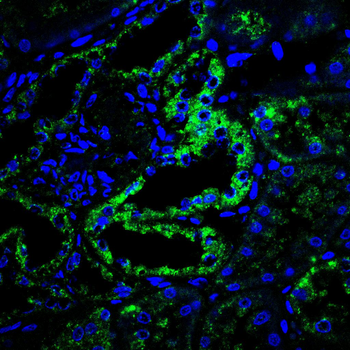 PIEZO1 Antibody