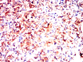 PIEZO1 Antibody