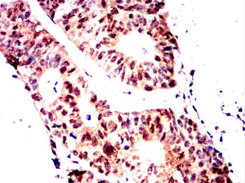 SKP1 Antibody