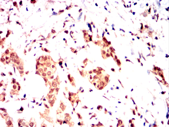 SKP1 Antibody