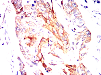 TNFRSF8 Antibody