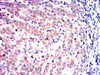 RAF1 Antibody