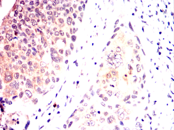 RAF1 Antibody