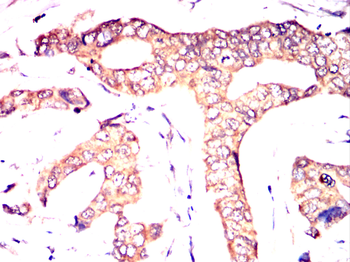 LRP5 Antibody