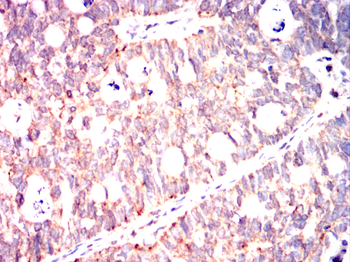 LRP5 Antibody
