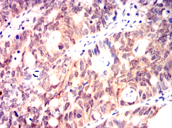 HSPA4 Antibody
