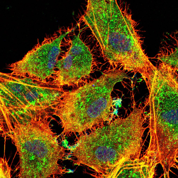 RPS6KA3 Antibody