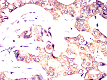 RPS6KA3 Antibody