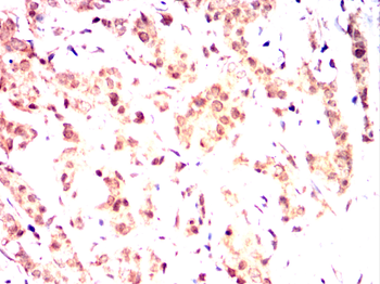 RPS6KA3 Antibody