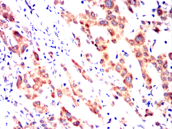 RPS6KA3 Antibody