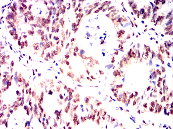 CBFA2T3 Antibody